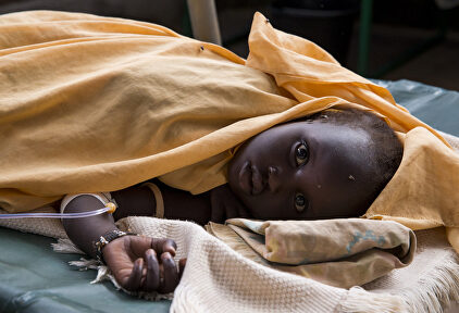 Un niño sursudanés recibe tratamiento contra el cólera en un centro de la ONU. | UN Photo/JC McIlwaine - Flickr
