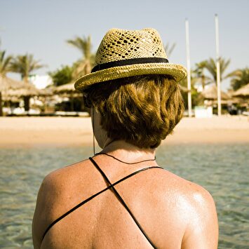 En verano hay que evitar la exposición al sol. |  Cordon Press