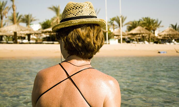 En verano hay que evitar la exposición al sol. |  Cordon Press