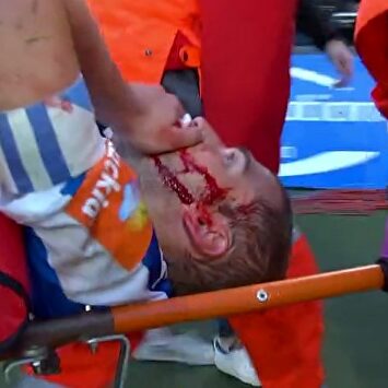 La durísima entrada de Pedraza a Bergantiños que le llevó al hospital