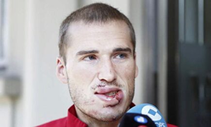 Alex Bergantiños tras abandonar el hospital | Twitter