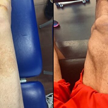 La transformación en las piernas de Sergi Vidal. | Twitter