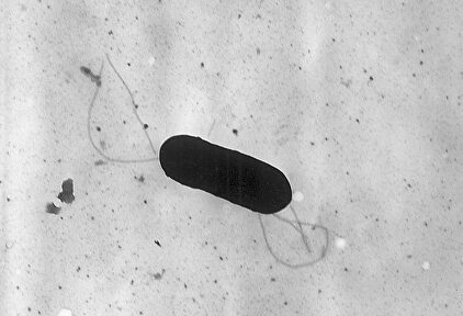 Bacteria de la listeriosis | Wikipedia