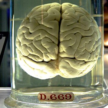 Un cerebro en formol. |  Wikipedia