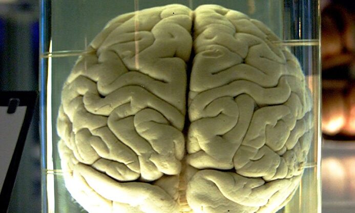 Un cerebro en formol. |  Wikipedia