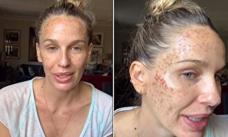 Carola Baleztena | Instagram