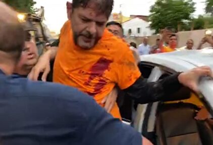 Cid Gomes, herido de bala. | EFE