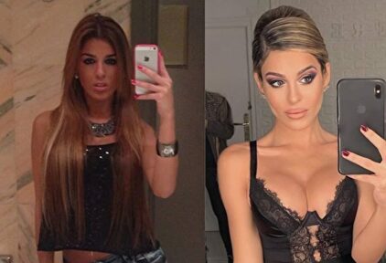 El antes y después de Oriana | Instagram @bellezafalsa