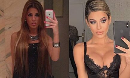 El antes y después de Oriana | Instagram @bellezafalsa