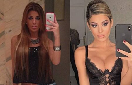 El antes y después de Oriana | Instagram @bellezafalsa