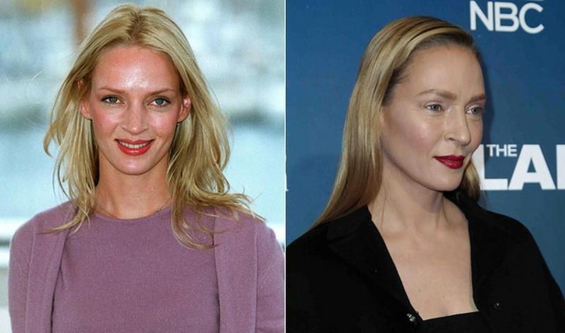 Antes / Despues - Página 2 Umairreconocible