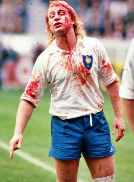 Un ensangrentado Jean Pierre Rives