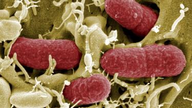 Imagen de la bacteria provocada por los pepinos. | EFE