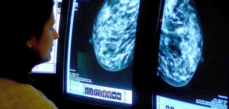 Análisis de una mamografía. | Cordon Press