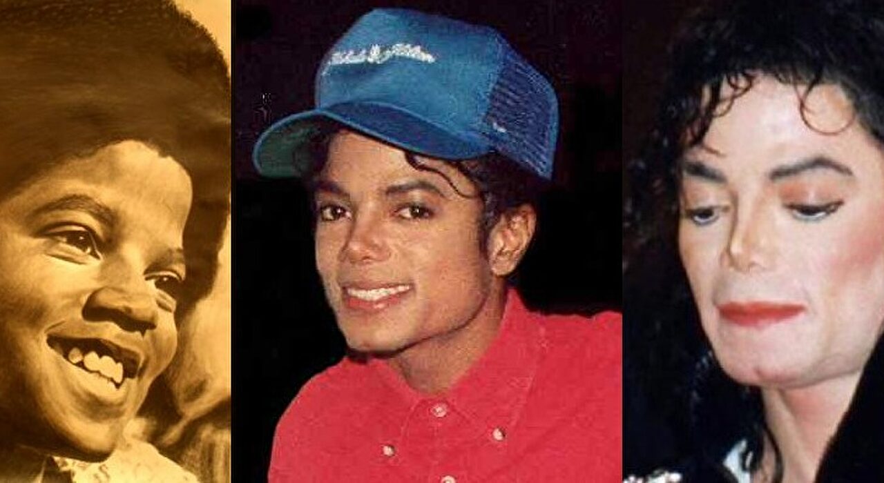 50 famosos, antes y después de la cirugía Chic