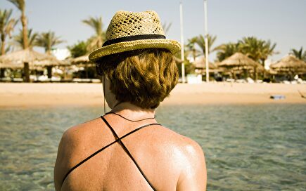 En verano hay que evitar la exposición al sol. |  Cordon Press