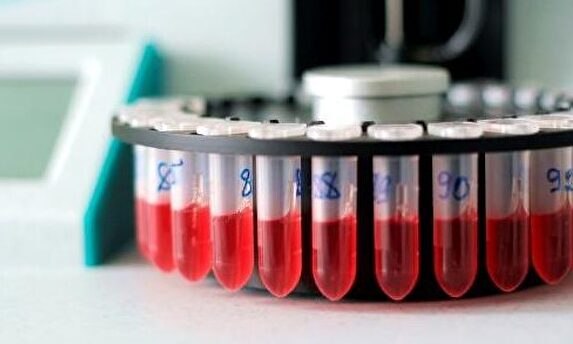 España ha creado un ensayo clínico en tiempo récord | EFE