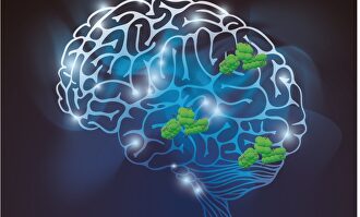 Así se trata el párkinson en la actualidad