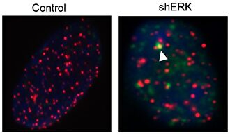 Nueva combinación de fármacos contra tumores cerebrales |  Cnio