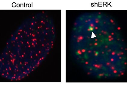 Nueva combinación de fármacos contra tumores cerebrales |  Cnio