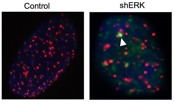 Nueva combinación de fármacos contra tumores cerebrales |  Cnio