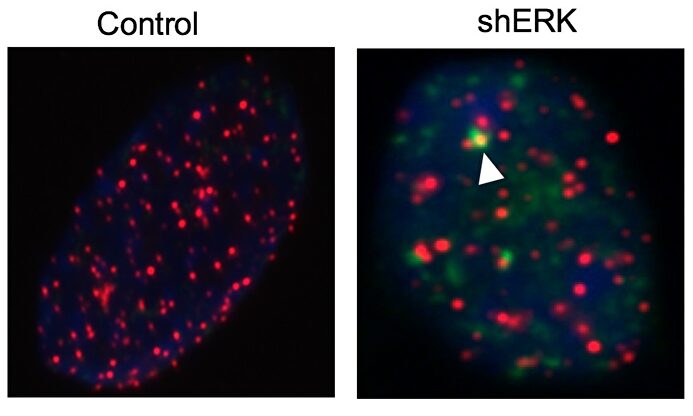 Nueva combinación de fármacos contra tumores cerebrales |  Cnio