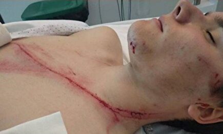 La herida que causa conmoción en Twitter |  Twitter