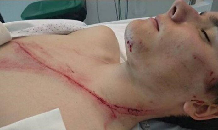 La herida que causa conmoción en Twitter |  Twitter