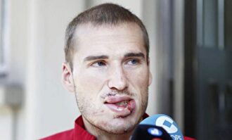 Alex Bergantiños tras abandonar el hospital |  Twitter