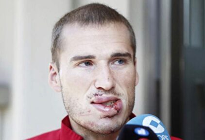 Alex Bergantiños tras abandonar el hospital |  Twitter