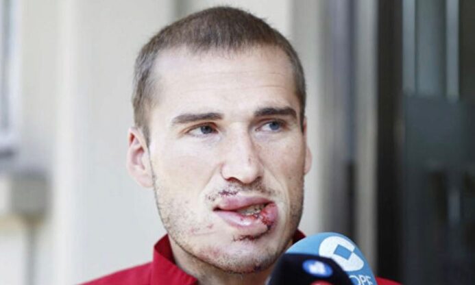 Alex Bergantiños tras abandonar el hospital |  Twitter