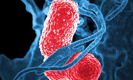 Las bacterias multirresistentes, una amenaza para los pacientes más débiles de los hospitales |  Pixabay/CC/skeeze