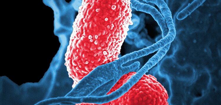 Las bacterias multirresistentes, una amenaza para los pacientes más débiles de los hospitales |  Pixabay/CC/skeeze