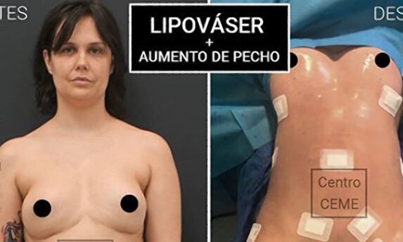 Miriam Sánchez |  Instagram