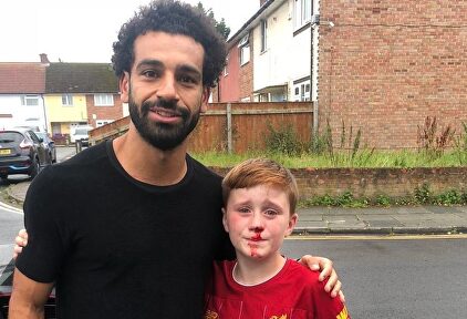 Salah posó con Louis tras chocar con una farola. |  @joecooper93