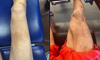 La transformación en las piernas de Sergi Vidal. |  Twitter