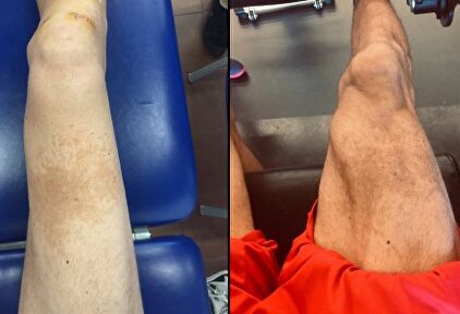 La transformación en las piernas de Sergi Vidal. |  Twitter