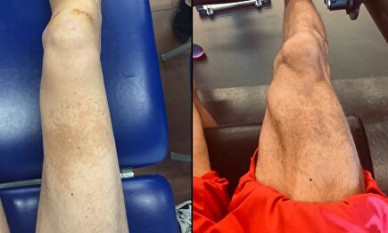 La transformación en las piernas de Sergi Vidal. |  Twitter