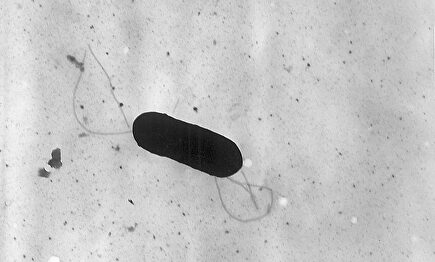 Bacteria de la listeriosis |  Wikipedia