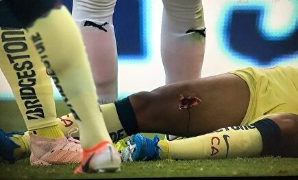 Así quedó la pierna del ex del Villarreal. |  Twitter