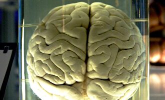 Un cerebro en formol. |  Wikipedia