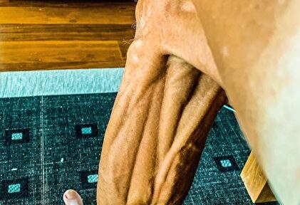 Así luce la pierna del veterano Janez Brajkovic |  Instagram