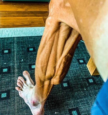 Así luce la pierna del veterano Janez Brajkovic |  Instagram