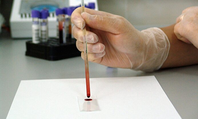 Una muestra de sangre en un laboratorio. | Pixabay/CC/PublicDomainPictures