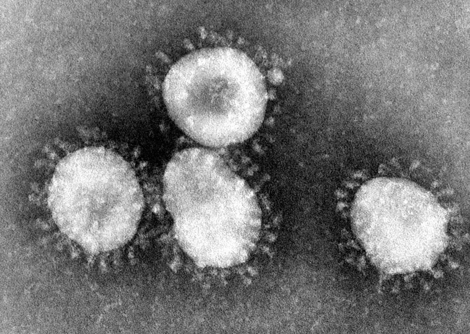La existencia de esta familia de virus se demostró en 2003, a través de un niño holandés que sufría una bronquitis.