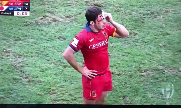 Orgullo español: se quita de encima al médico para placar a un rival con la cabeza llena de sangre