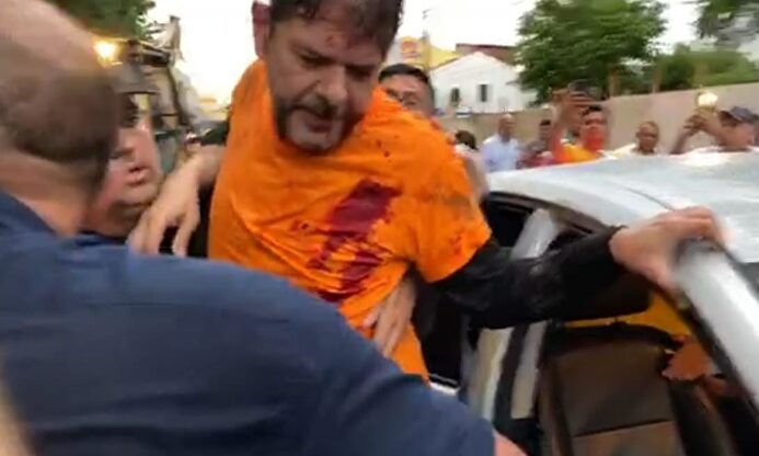 Cid Gomes, herido de bala. |  EFE