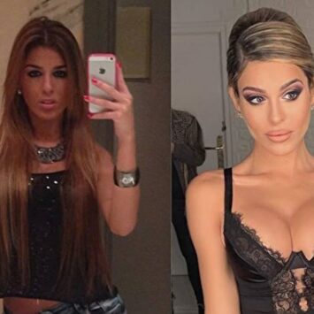 El antes y después de Oriana |  Instagram @bellezafalsa