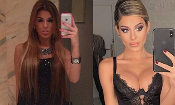 El antes y después de Oriana |  Instagram @bellezafalsa