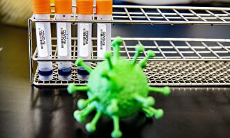 Muestras de laboratorio de Coronavirus | Cordon Press
